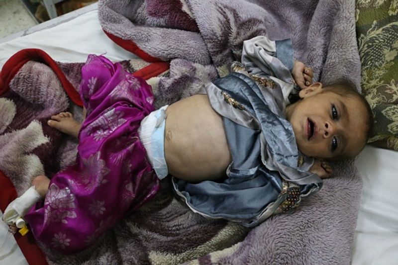 UN warns child mortality in afghan