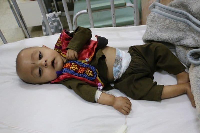 UN warns child mortality in afghan