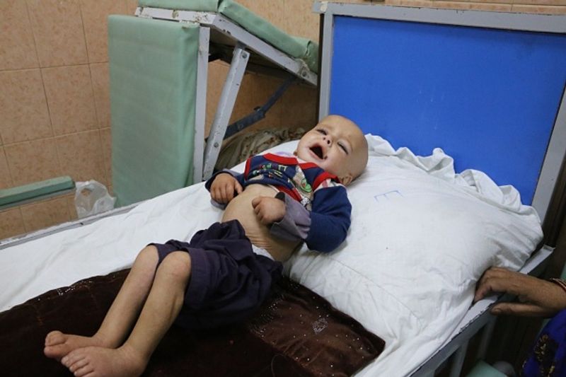 UN warns child mortality in afghan