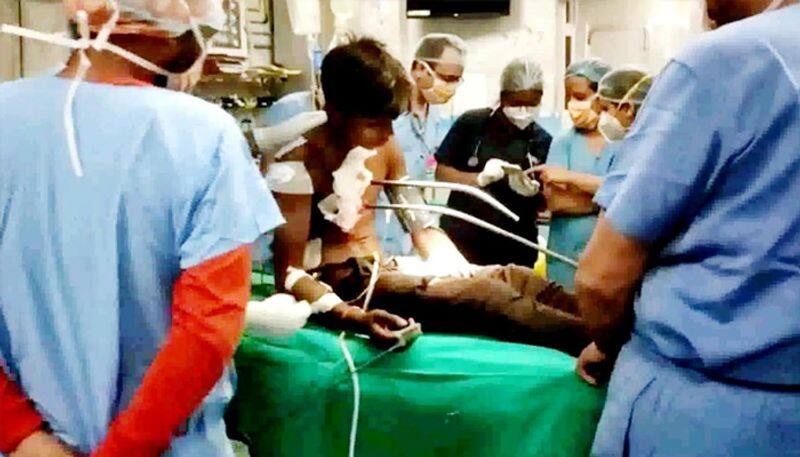 Haryana news two iron rods of 40 feet long passed through the chest of a man in Rohtak