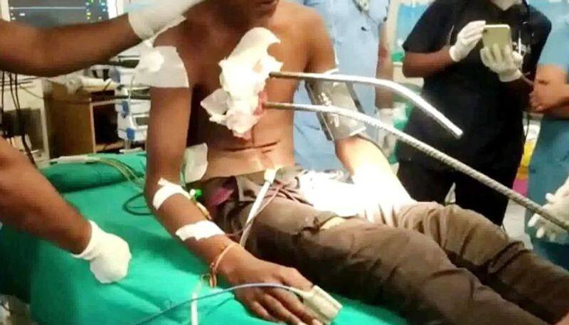 Haryana news two iron rods of 40 feet long passed through the chest of a man in Rohtak