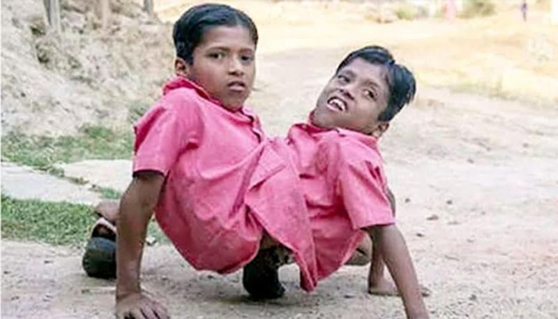 Chhattisgarh twin brothers famous famous in country die together of baloda bazar
