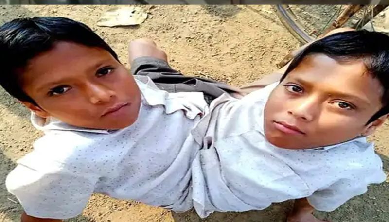 Chhattisgarh twin brothers famous famous in country die together of baloda bazar