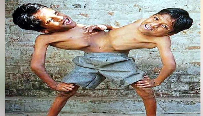 Chhattisgarh twin brothers famous famous in country die together of baloda bazar