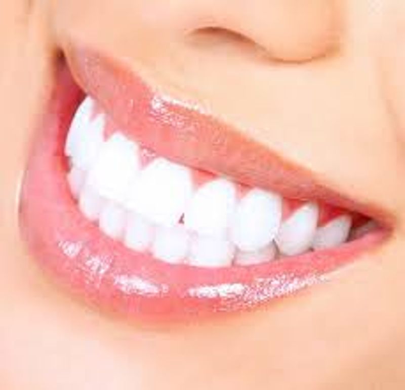 Must follow this tips for sparkling white teeth full details are here