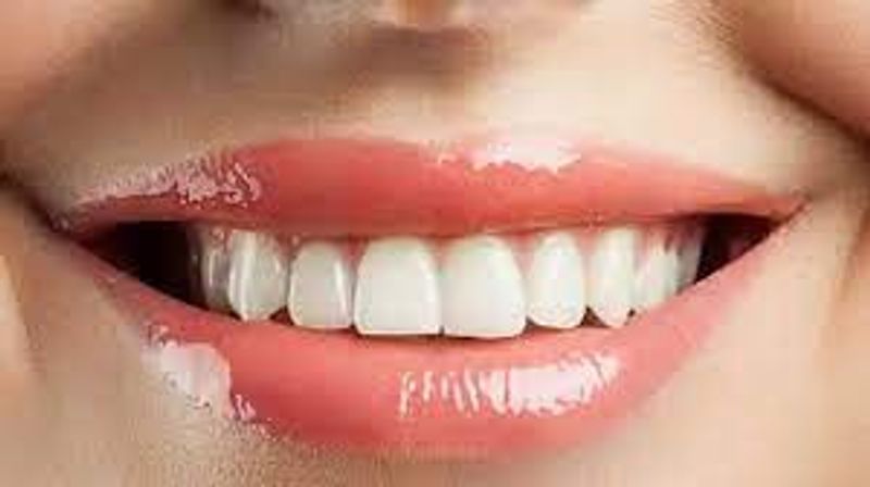 Must follow this tips for sparkling white teeth full details are here