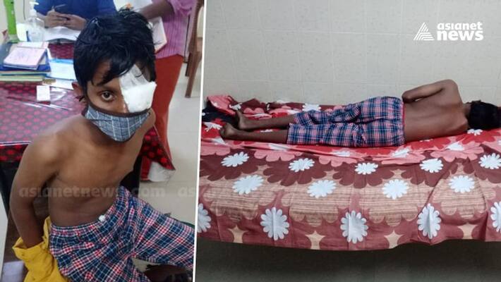 students eye injured in neighbors attack students eye injured in neighbors attack