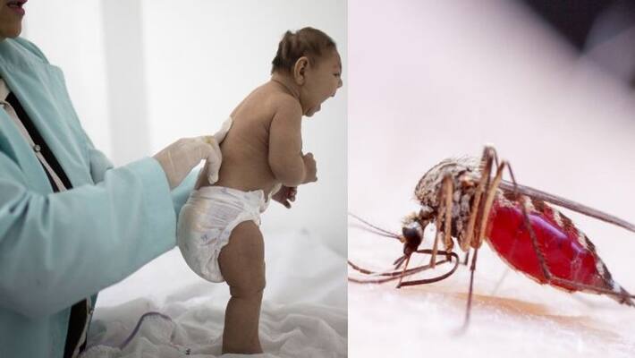 zika virus is dangerous for unborn babies zika virus is dangerous for unborn babies