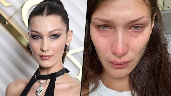 Bella Hadid shared crying selfies, read to know what happened