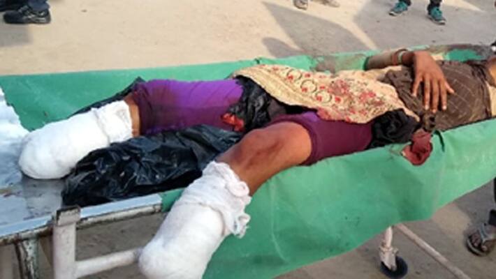 Hungary man cuts off both his legs to claim insurance amount kpn Hungary man cuts off both his legs to claim insurance amount kpn