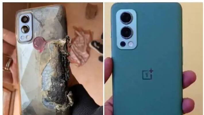 OnePlus Nord 2 5G Explosion: User Who Suffered Severe Burns Gets Refund, Medical Expenses OnePlus Nord 2 5G Explosion: User Who Suffered Severe Burns Gets Refund, Medical Expenses
