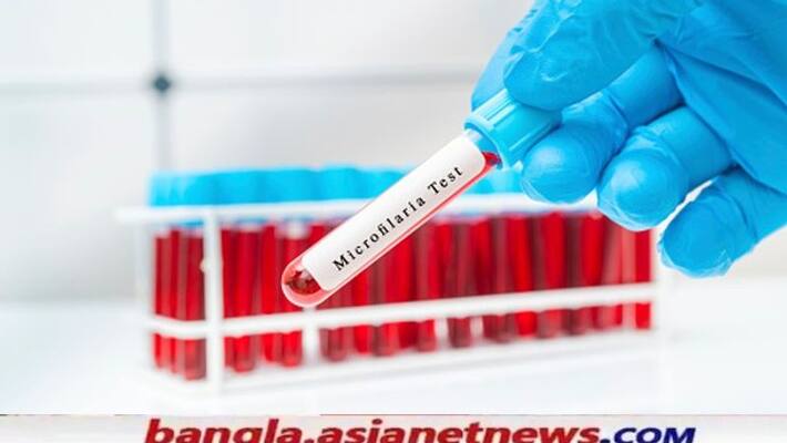 Filaria testing has started in West Bengal to keep children safe RTB Filaria testing has started in West Bengal to keep children safe RTB