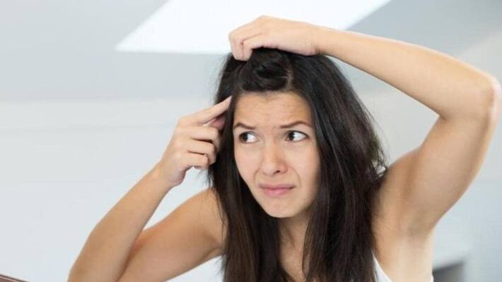 how to reduce dandruff in home how to reduce dandruff in home