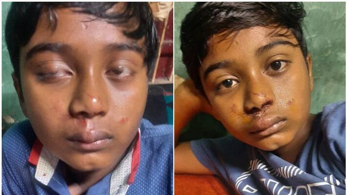 horse attacked 12 year old boy in idukki horse attacked 12 year old boy in idukki