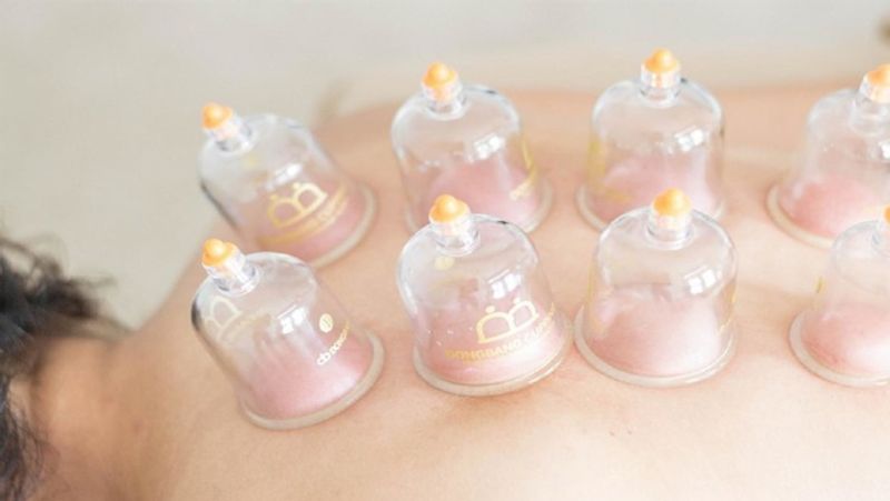 What is Cupping therapy, know its benefits, process and treatment dva