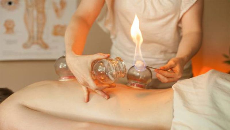 What is Cupping therapy, know its benefits, process and treatment dva