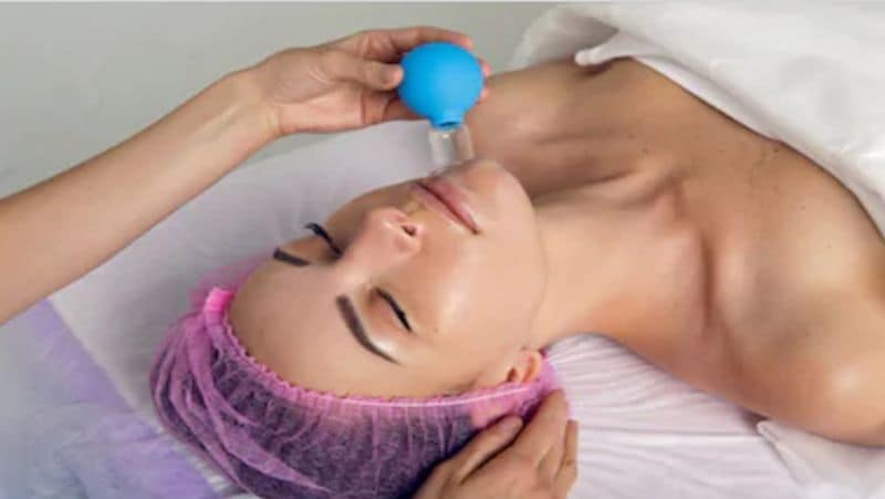 What is Cupping therapy, know its benefits, process and treatment dva