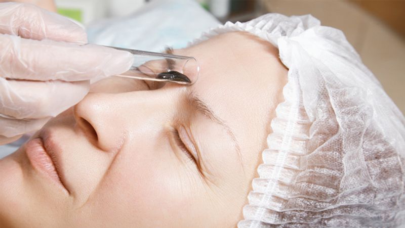 Leech Therapy: what is jonk therapy, know its benefits, advantage and disadvantage dva