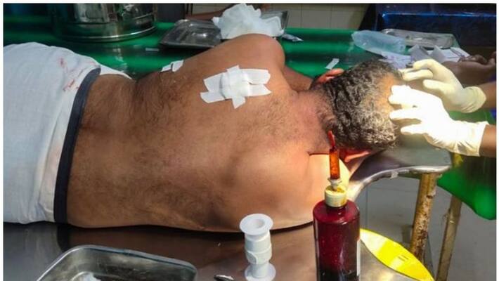 Father of girl attacked by stalker in wedding party Father of girl attacked by stalker in wedding party