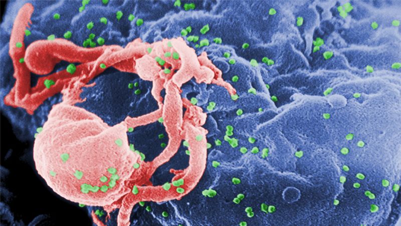 World Aids Day 2021: AIDS also spread in animals, now what research says dva