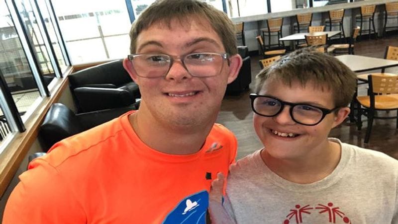 World Disability Day 2021: what is Down syndrome? know its Symptoms, causes and treatment dva