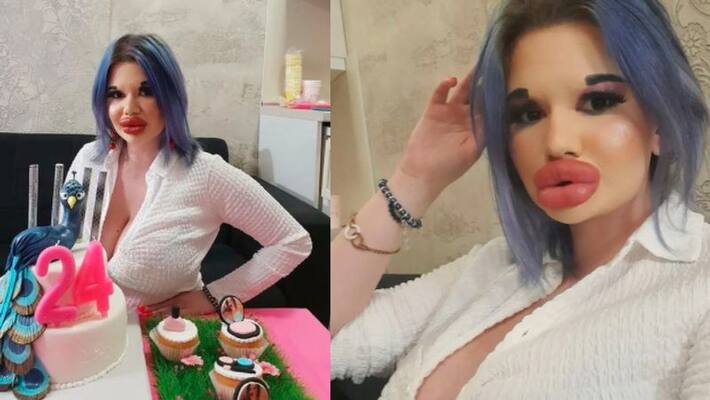 Bulgaria Andrea Ivanova has the biggest lips in the world kpn Bulgaria Andrea Ivanova has the biggest lips in the world kpn