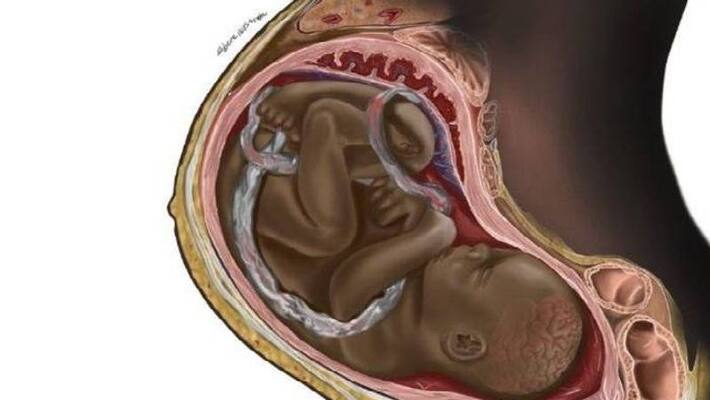 Black Fetus illustration went viral on social media Black Fetus illustration went viral on social media