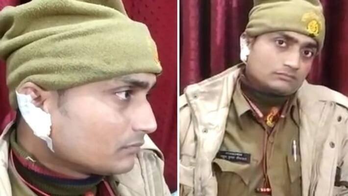 Police arrived to resolve the dispute of two parties, the bullies cut off the ear of the soldier, the police engaged in search of the accused Police arrived to resolve the dispute of two parties, the bullies cut off the ear of the soldier, the police engaged in search of the accused