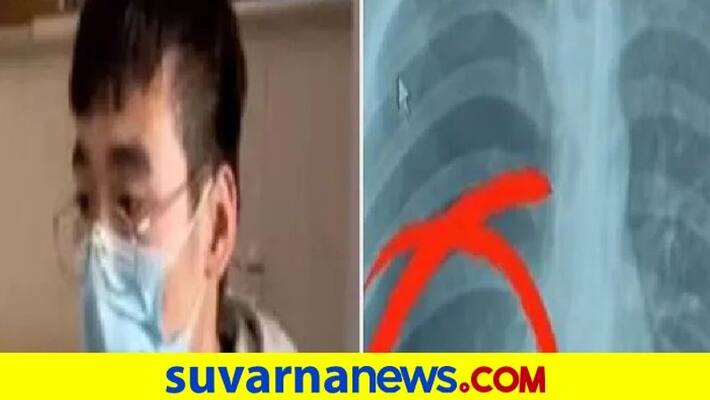 Man In China Suffers Collapsed Lung After Singing His Heart Out During Karaoke pod Man In China Suffers Collapsed Lung After Singing His Heart Out During Karaoke pod