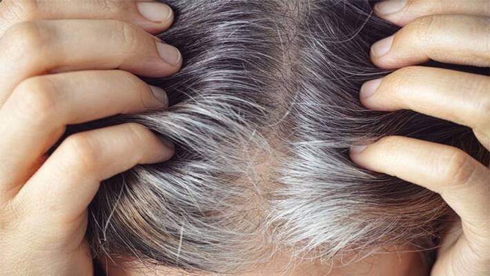 The real reason why hair turns white at the age of 25 to 30 BDD The real reason why hair turns white at the age of 25 to 30 BDD