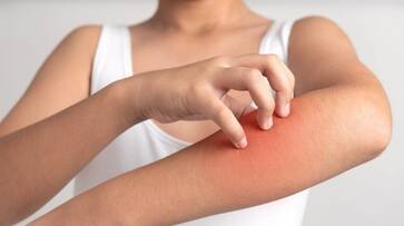 diseases caused by deficiency of vitamin c diseases caused by deficiency of vitamin c