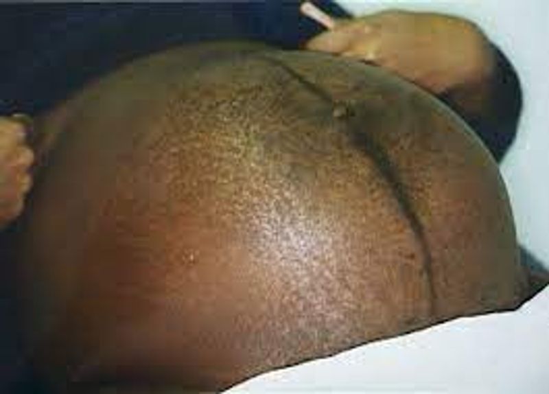 Know the full details about skin darkening during pregnancy