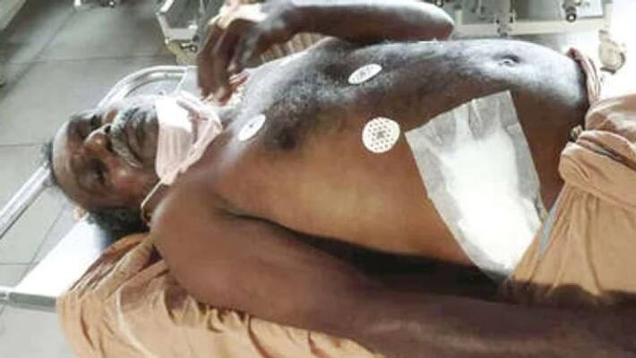 Wild boar attack, auto driver seriously injured in Kilimanoor Wild boar attack, auto driver seriously injured in Kilimanoor
