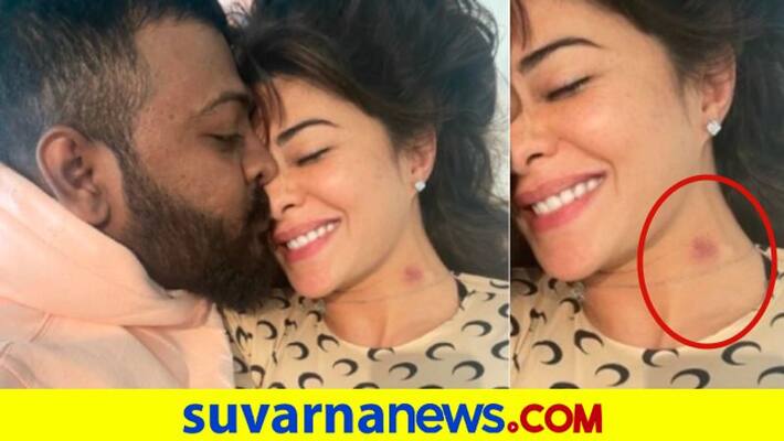 Jacqueline Fernandez photo with Sukesh Chandrasekhar surfaces online shows love bite dpl Jacqueline Fernandez photo with Sukesh Chandrasekhar surfaces online shows love bite dpl