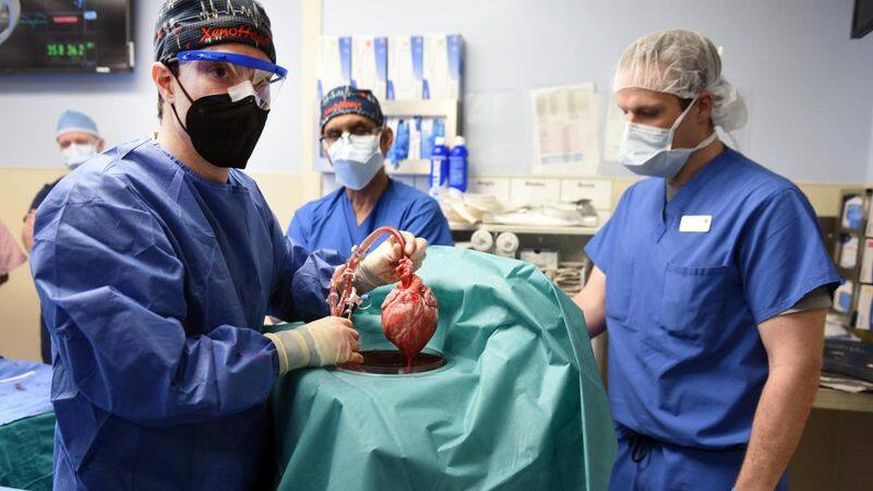 Should criminal history affect who gets lifesaving organs ALB