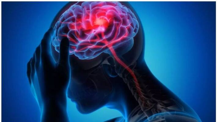 Lifestyle Habits Put At Risk Of A Brain Stroke Lifestyle Habits Put At Risk Of A Brain Stroke