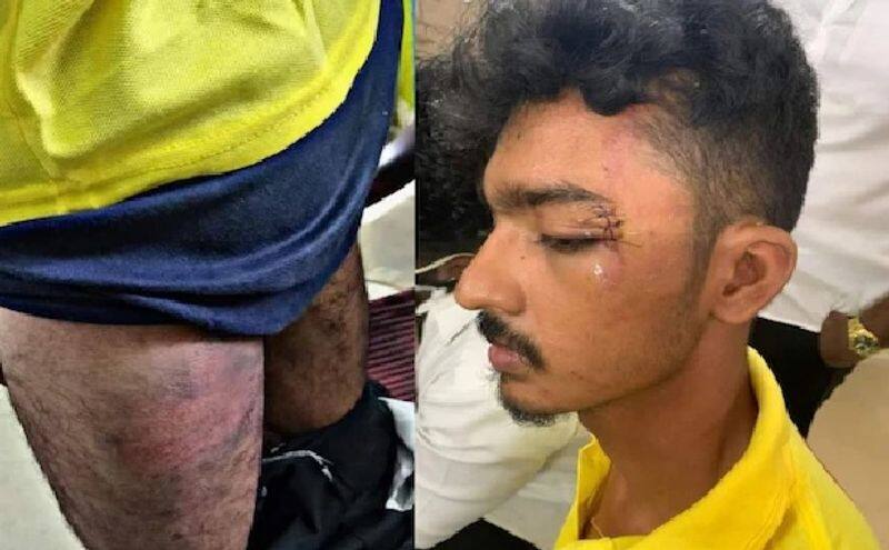 2 police officers suspended for law student assault case