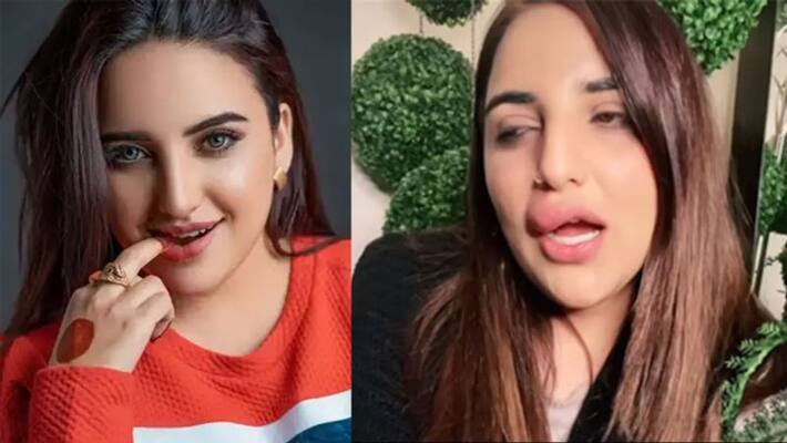 Pakistani Tiktokker Harim Shah spilled with swollen lips kpg Pakistani Tiktokker Harim Shah spilled with swollen lips kpg