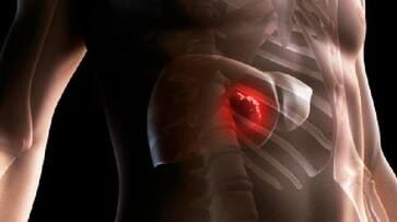 symptoms of Liver cancer of in tamil symptoms of Liver cancer of in tamil