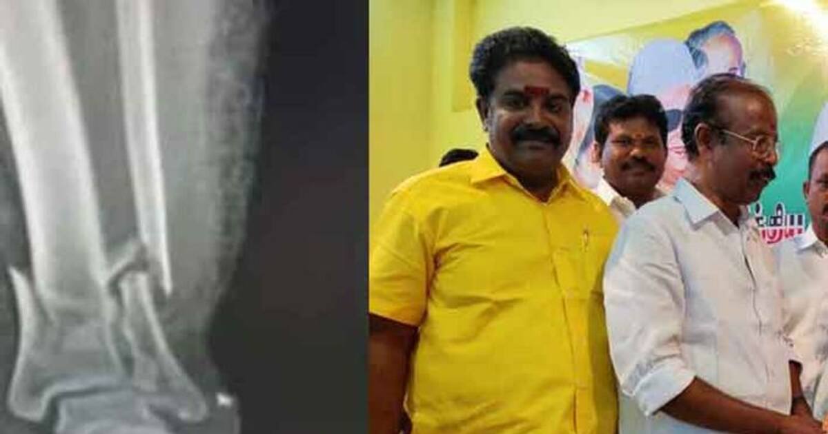 கட்சி மாறினால் எவனாக இருந்தாலும் வீடு புகுந்து வெட்டுவேன்.. அலும்பு பேசி எலும்பை முறித்துக்கொண்ட ADMK நிர்வாகி