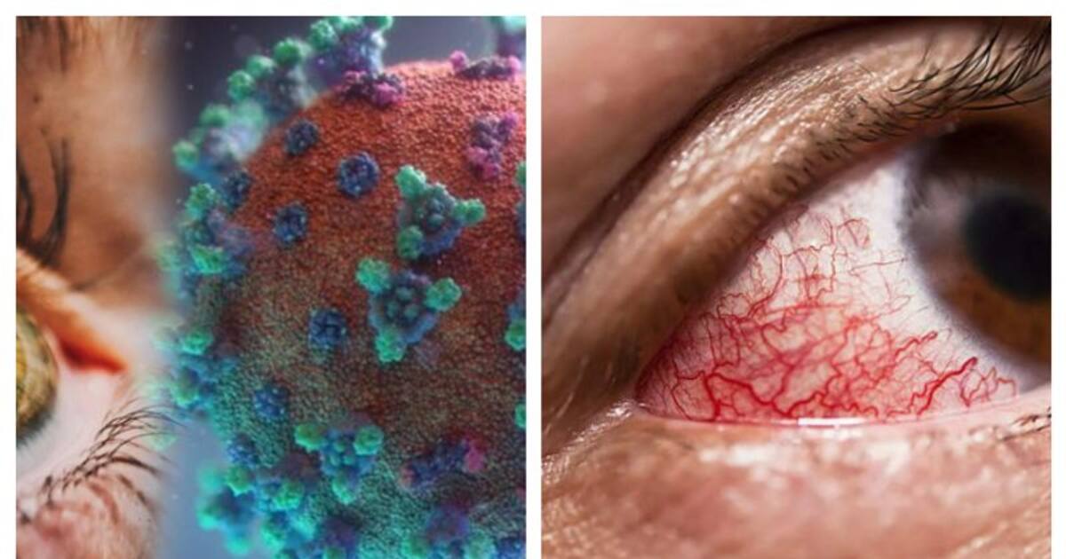 Omicron new symptoms: கண்களை குறிவைத்து தாக்கும் `ஒமிக்ரான்'...இனி இந்த அறிகுறிகள் இருந்தால் அலெர்ட்டா இருங்கோ