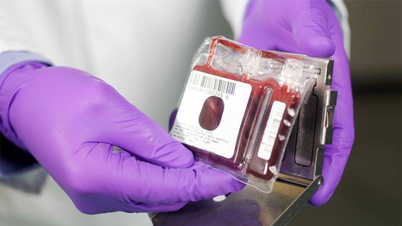 Why parents should save their baby's cord blood, know what is placenta banking and its benefits dva