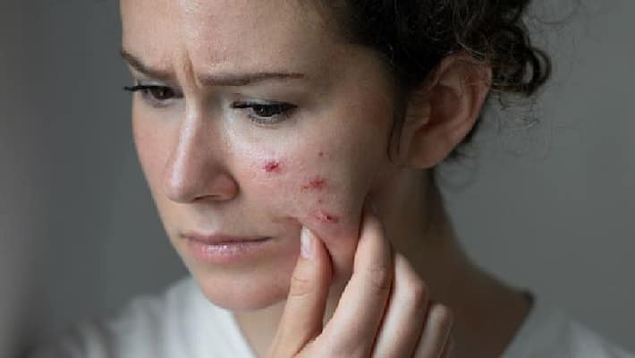 Those mistakes increase oily skin problems ABSC Those mistakes increase oily skin problems ABSC