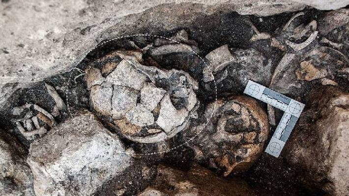 5300 year old evidence of ear surgery 5300 year old evidence of ear surgery