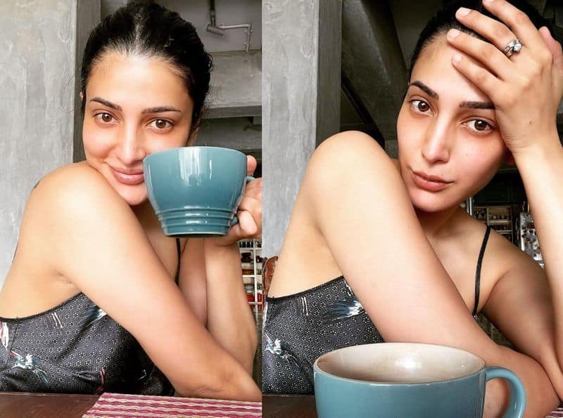 Shruti Haasan is fighting PCOS and endometriosis shares her heart in an Instagram post rps
