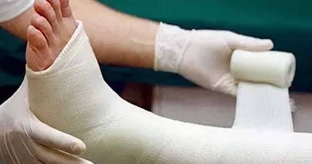 ஜெயிலில் இருந்து வந்ததுமே வேலையை காட்ட ஆரம்பித்த பிரபல ரவுடி.. தடுக்கி விழுந்து கை, கால் முறிவு.!