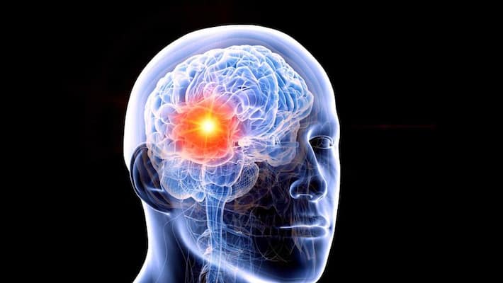 People Ignore These Signs Of Clot Formation In The Brain, It Can Be Heavy bpsb People Ignore These Signs Of Clot Formation In The Brain, It Can Be Heavy bpsb