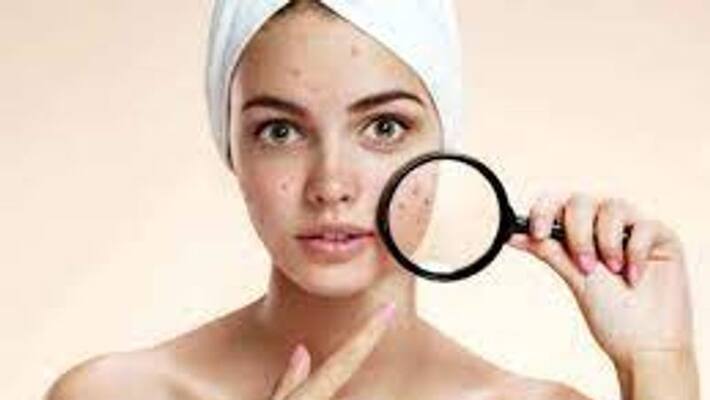 Salicylic acid is beneficial for the skin, these problems go away bpsb Salicylic acid is beneficial for the skin, these problems go away bpsb
