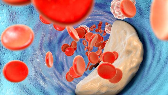 five foods that cause high cholesterol five foods that cause high cholesterol