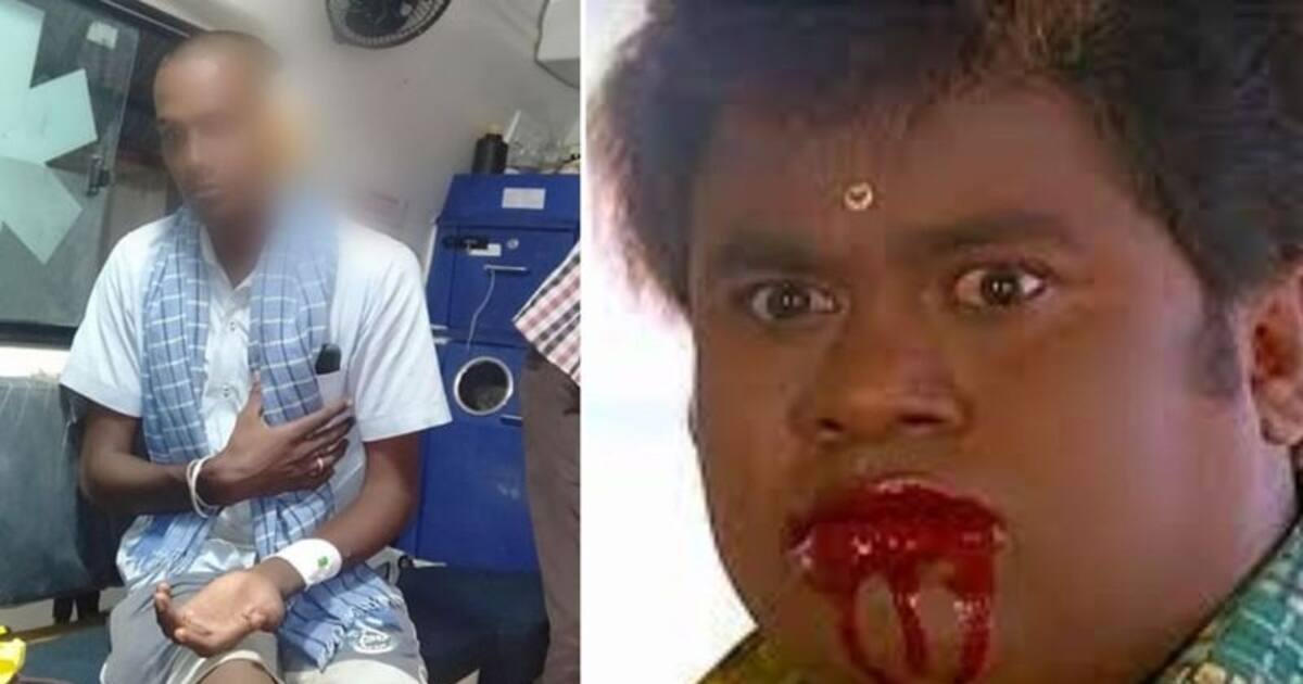 மண் கொட்டியதில் தகராறு.. சண்டை போட்டவரின் காதை கடித்து துப்பிய நபர்.. வைரல் சம்பவம் !! 